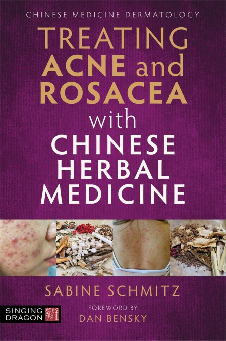 Treating Acne and Rosacea with Chinese Herbal Medicine